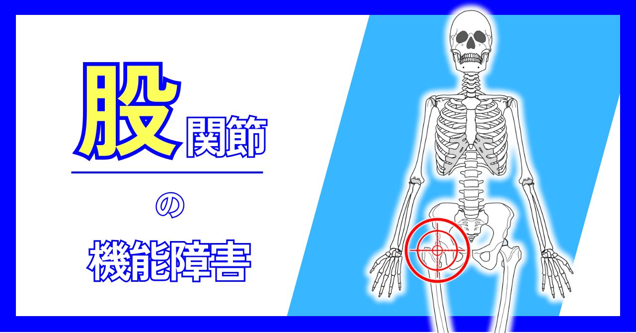 股関節周囲の機能障害